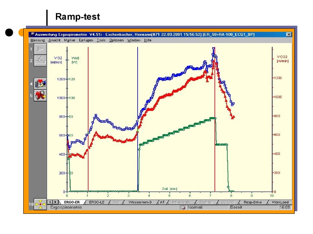Ramp Test Set Market